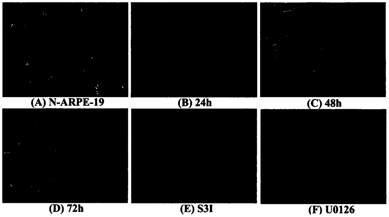 Epithelial-mesenchymal transition model of retinal pigment epithelium and its application