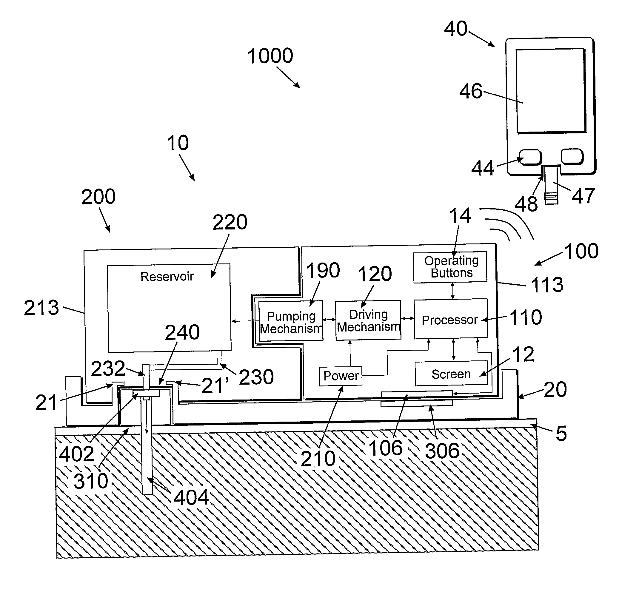 Portable infusion device with means for monitoring and controlling fluid delivery