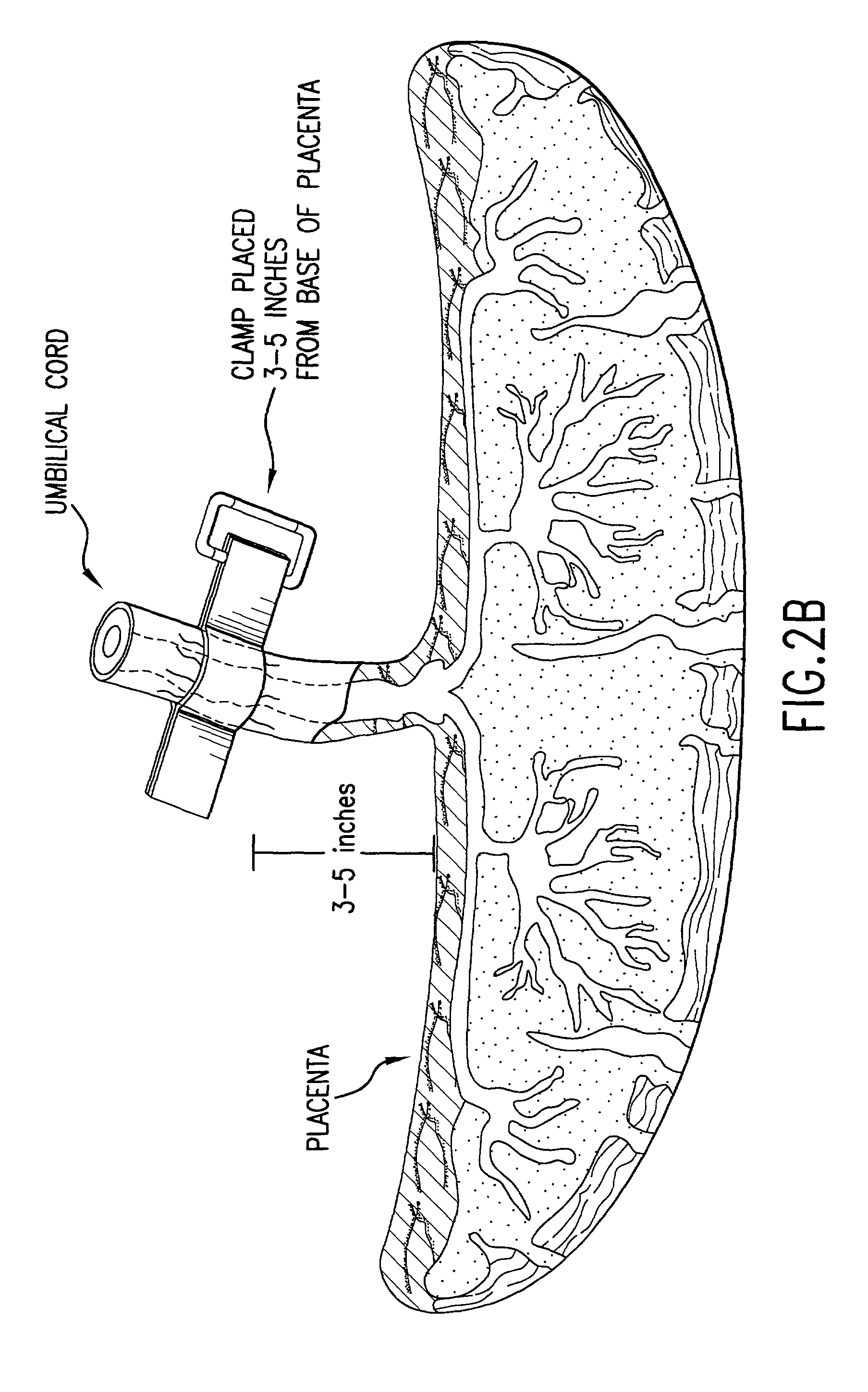 Post-partum mammalian placenta, its use and placental stem cells therefrom