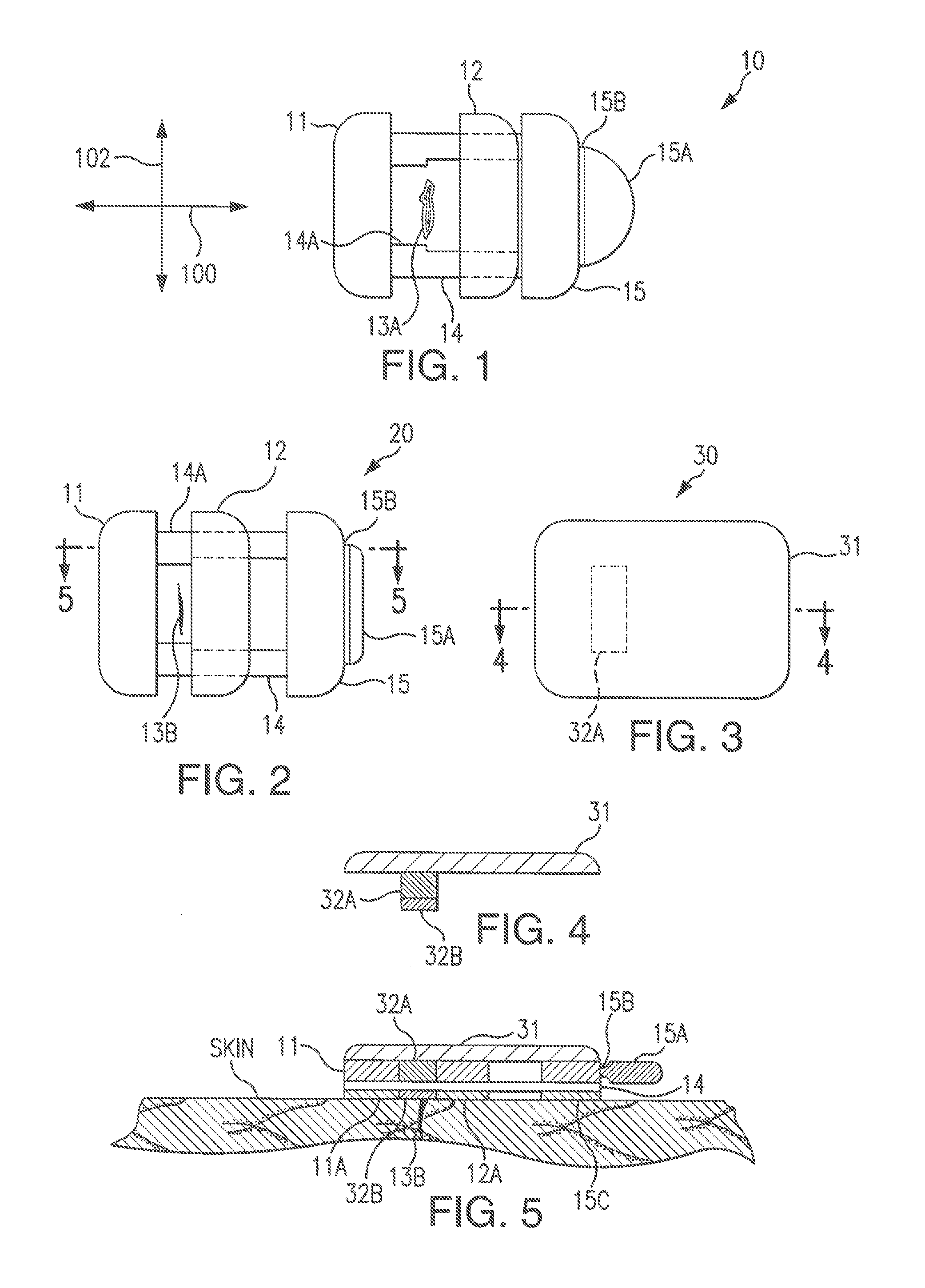 Device for the rapid closure of wounds and surgical incisions