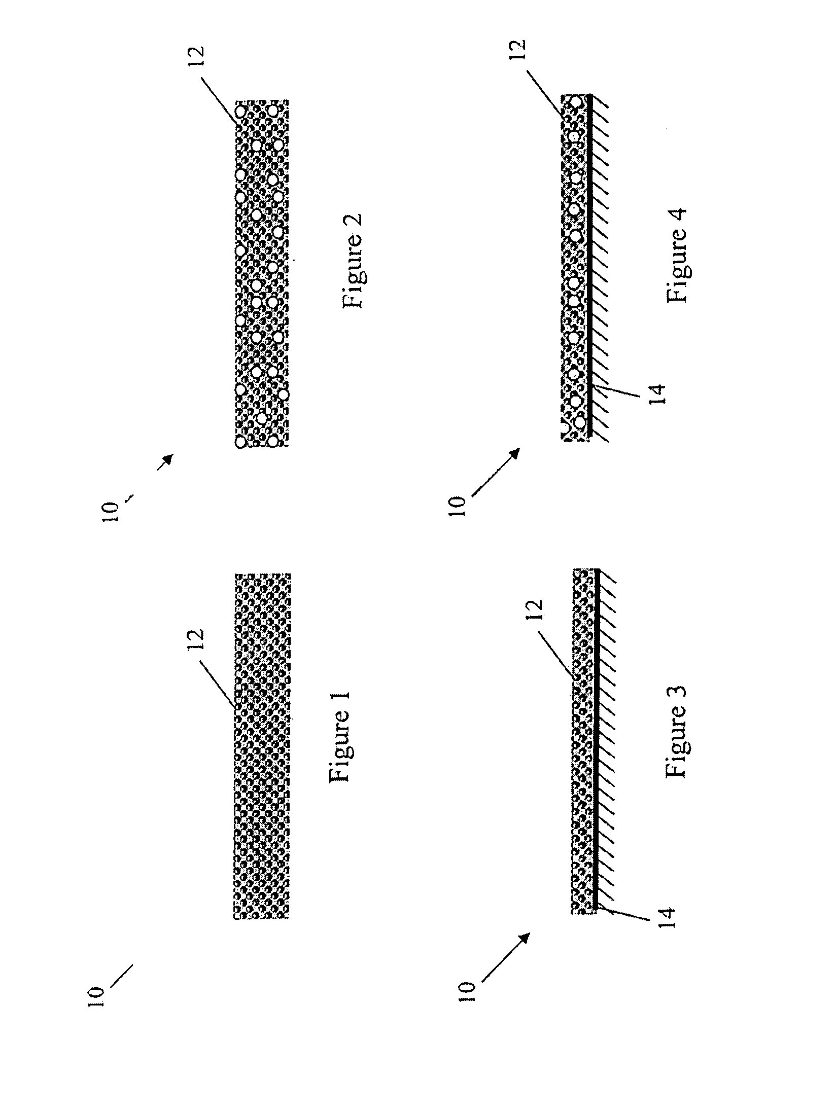 Lumen - supporting devices and methods of making and using