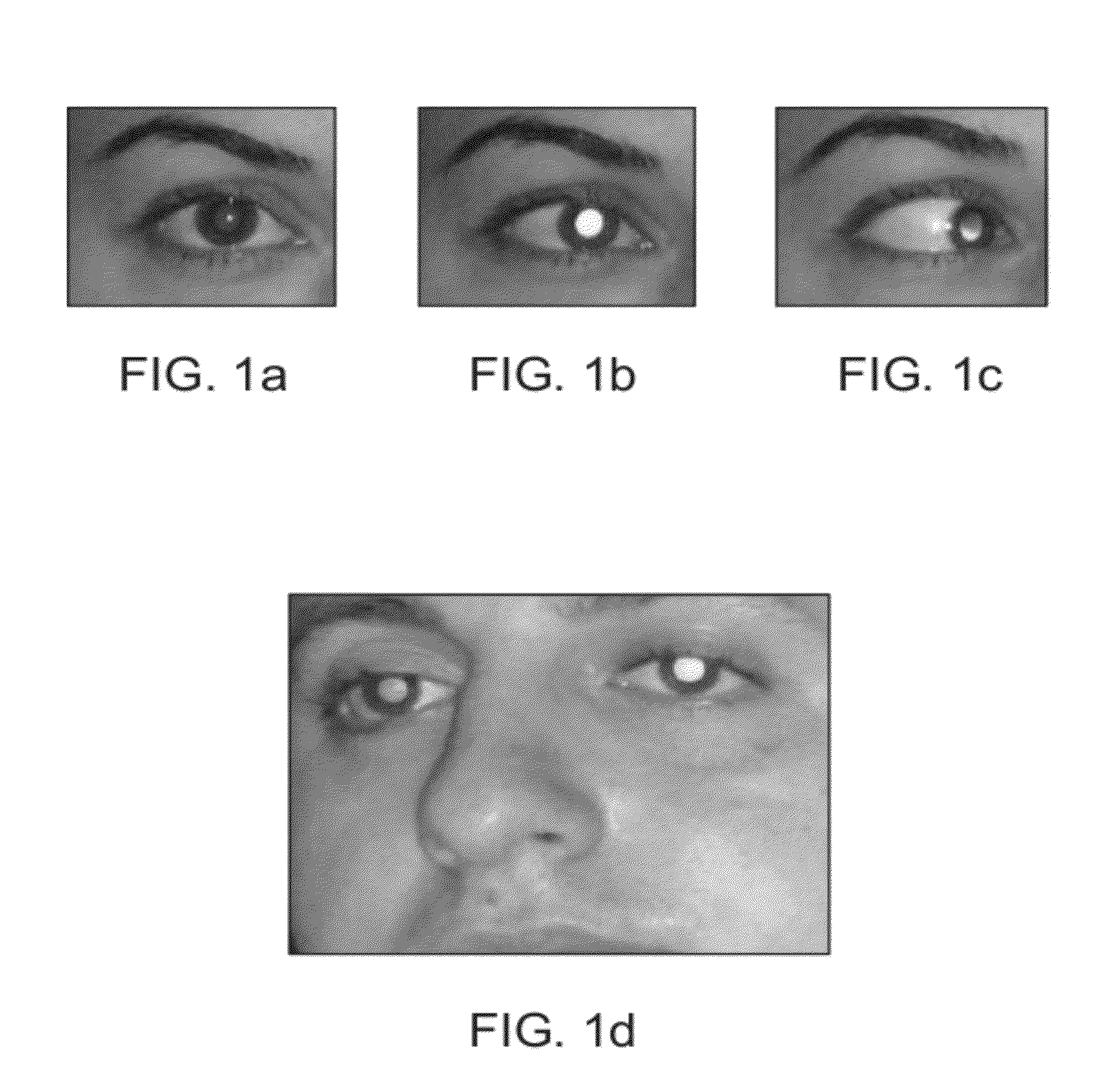 Methods and Apparatuses for Using Image Acquisition Data to Detect and Correct Image Defects