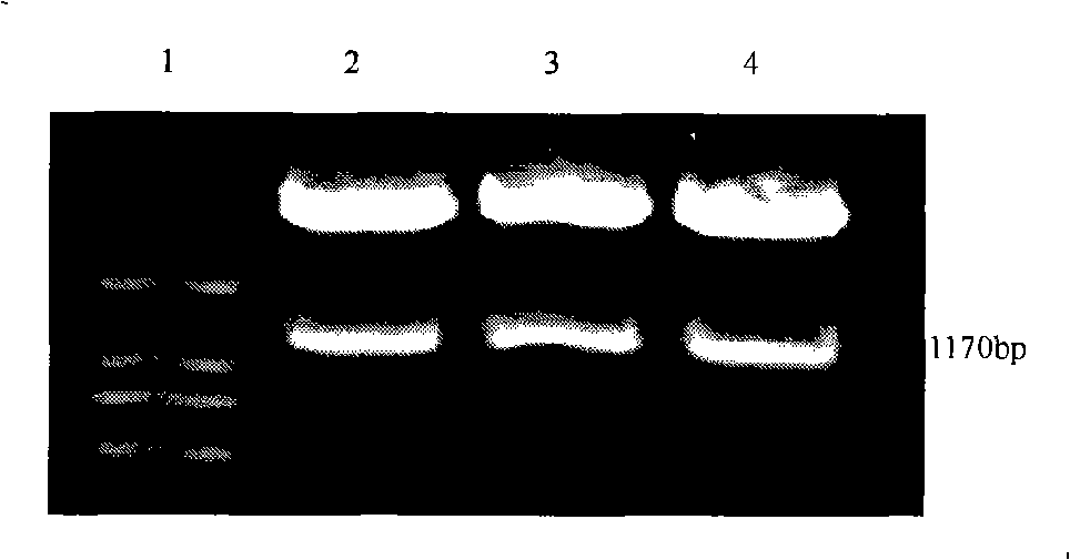 Common expression CTLA4Ig and CTLA4 recombinant adenovirus carrier, recombinant adenovirus and uses thereof