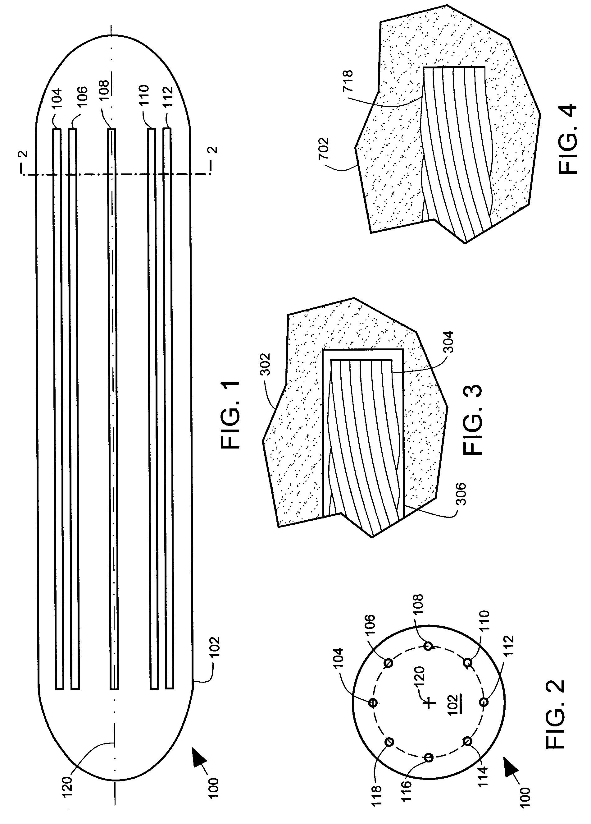Malleable prosthesis with enhanced concealability