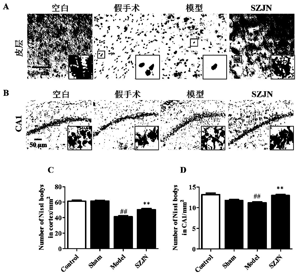 Application of ginseng and jujube brain-strengthening oral liquid to preparation of drug for preventing and/or treating Alzheimer disease (AD)