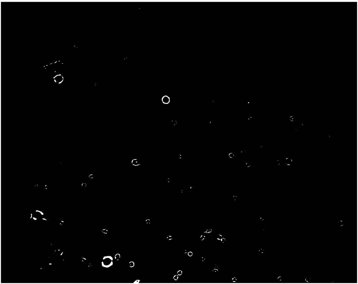 ACF-based urine sediment detection method