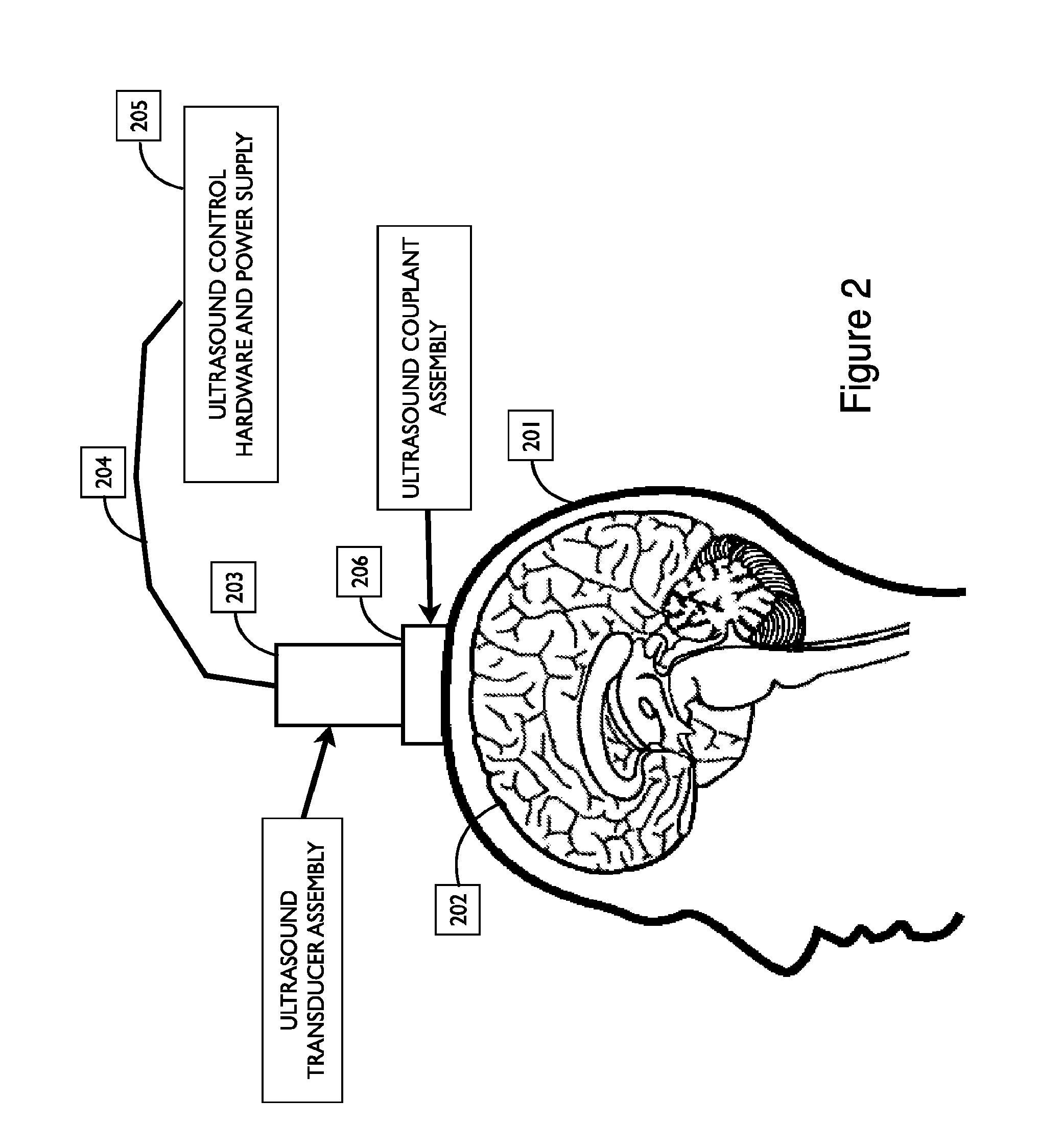 Systems and devices for coupling ultrasound energy to a body