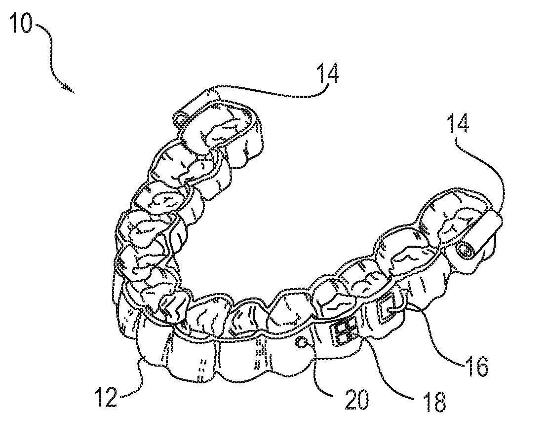 Embedded features and methods of a dental appliance