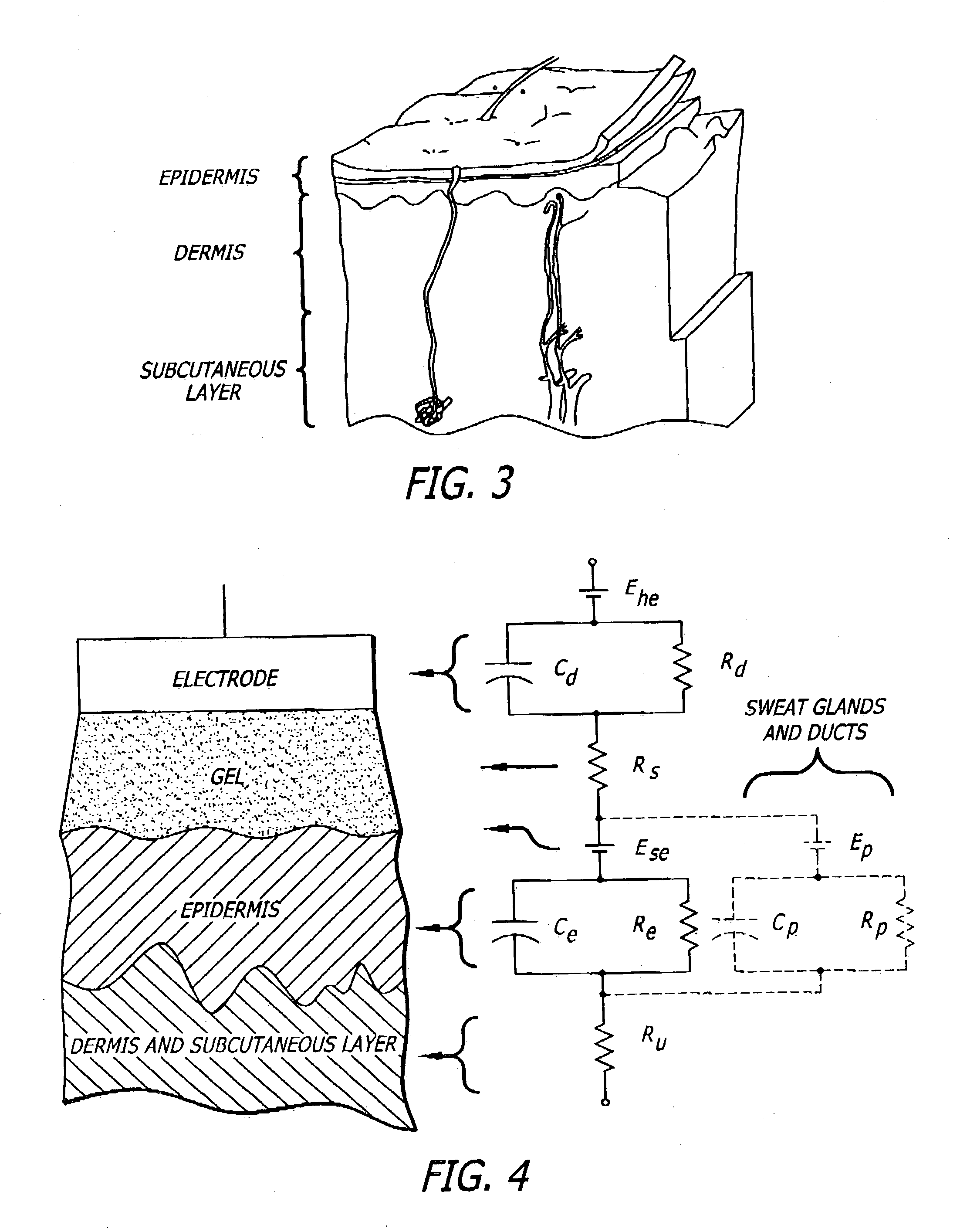 Amplified system for determining parameters of a patient