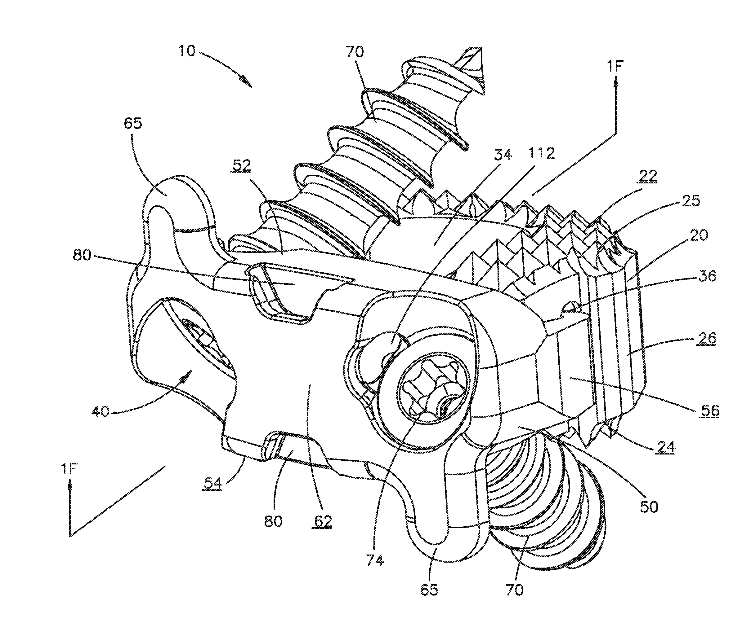 Zero-profile interbody spacer and coupled plate assembly