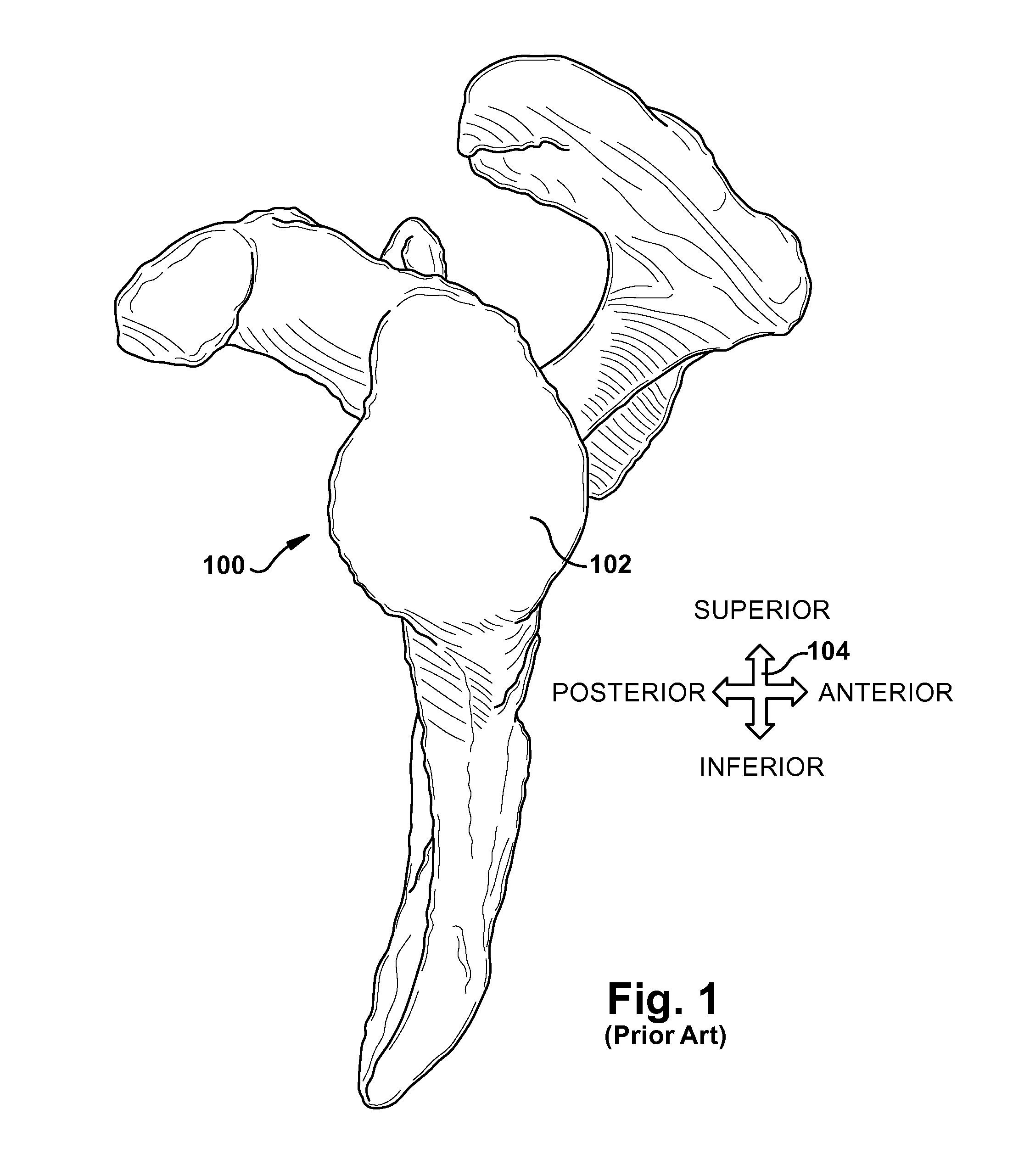 System and method for assisting with arrangement of a stock instrument with respect to a patient tissue