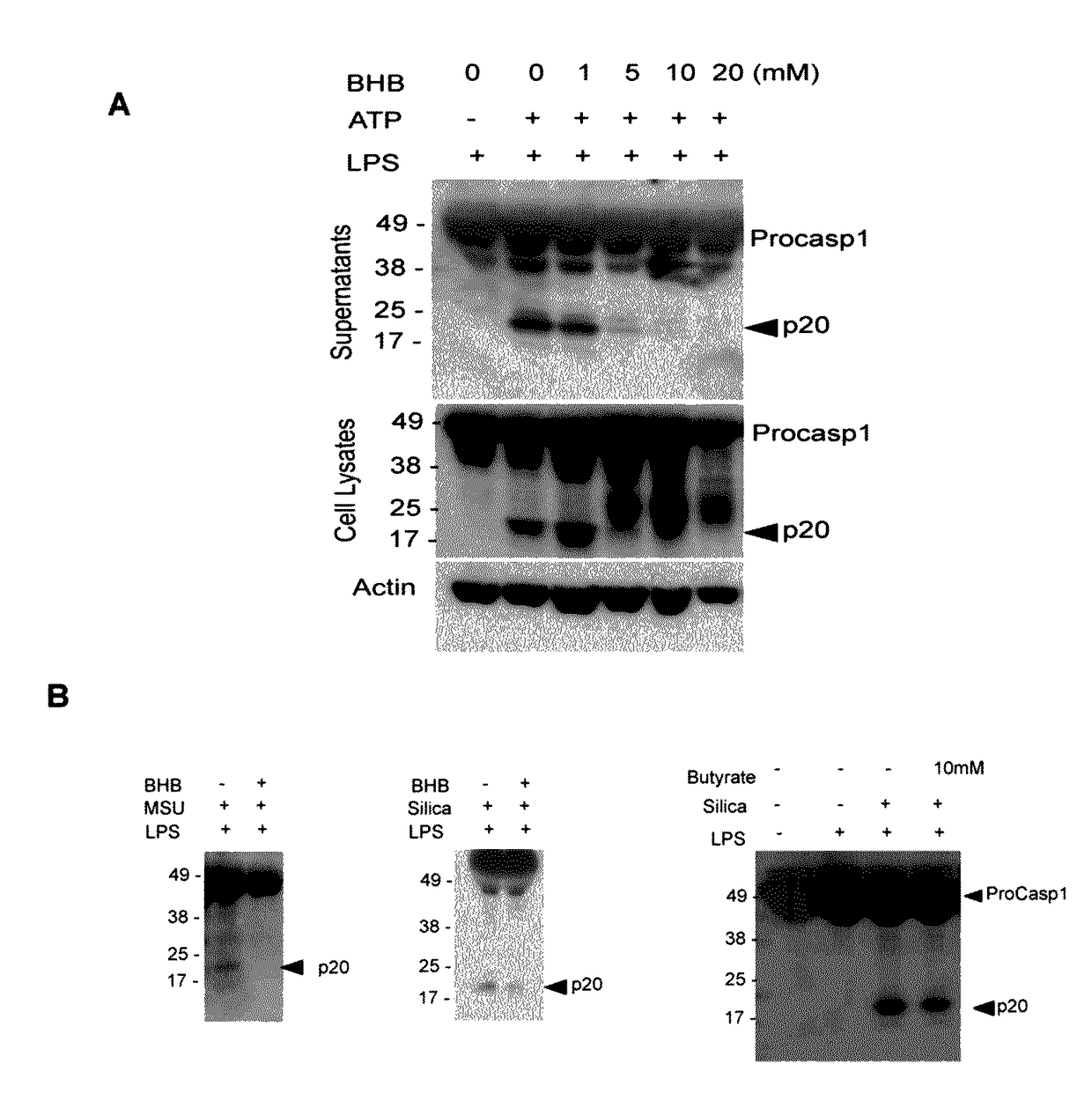Compositions and Methods for Treating NLRP3 Inflammasome-Related Diseases and Disorders