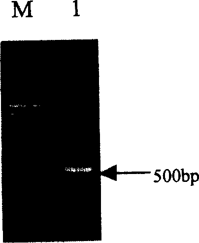 Recombinant protein molecule for inhibiting attack and transfer of cancer cell and angiogenesis