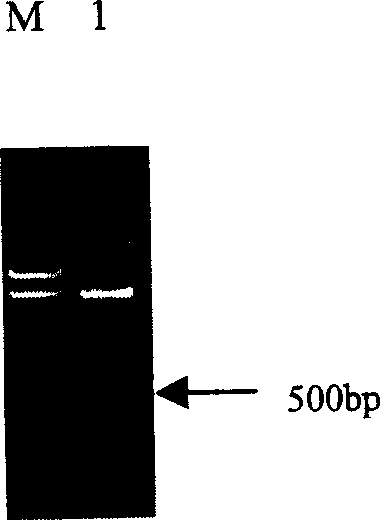 Recombinant protein molecule for inhibiting attack and transfer of cancer cell and angiogenesis