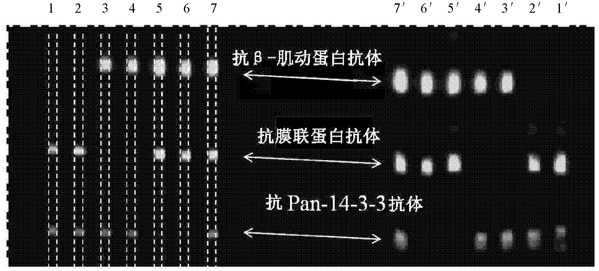 Multiphase microfluidic immunoblotting chip, and preparation method and application thereof