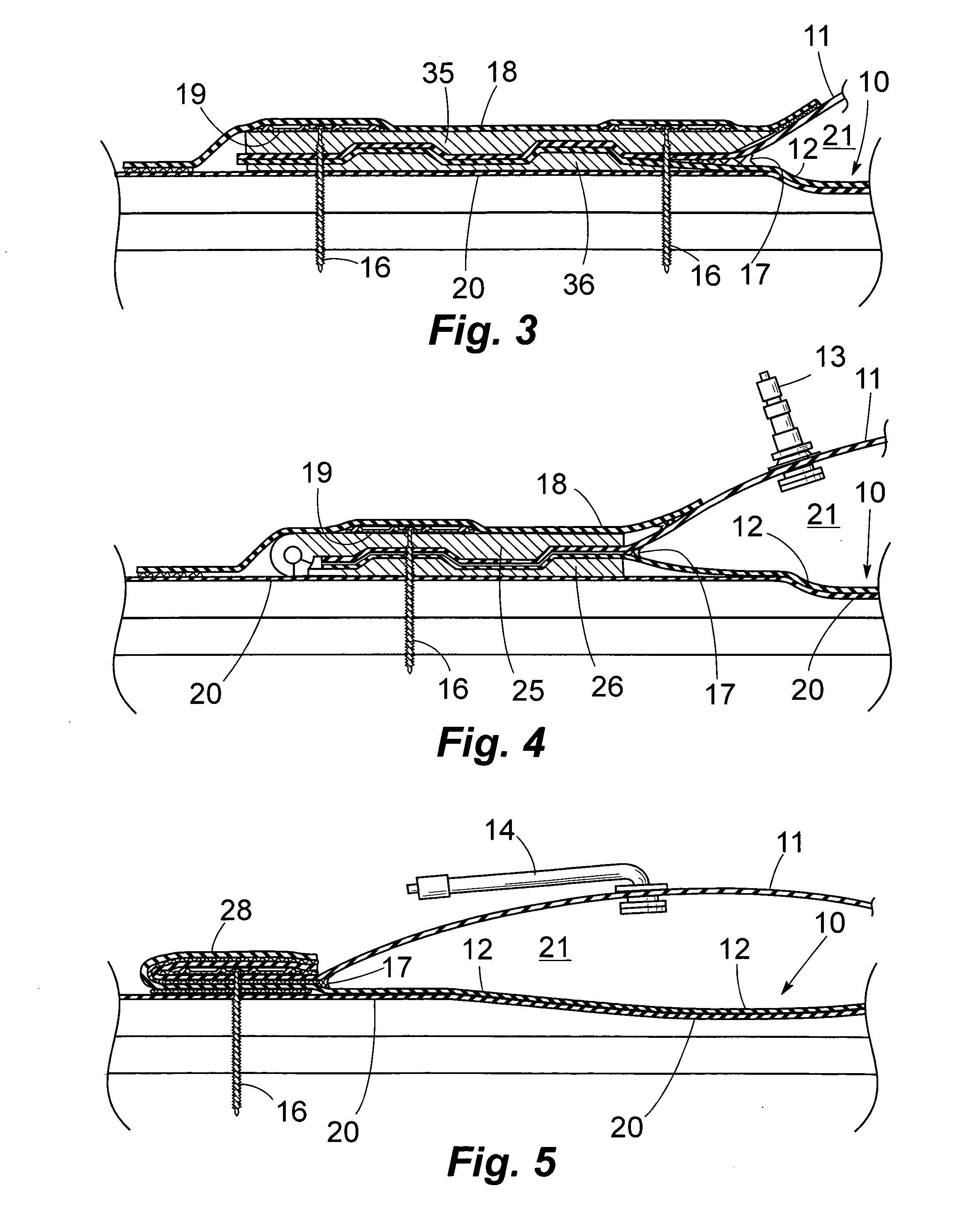 Device with inflatable membrane for raising flat roof low areas