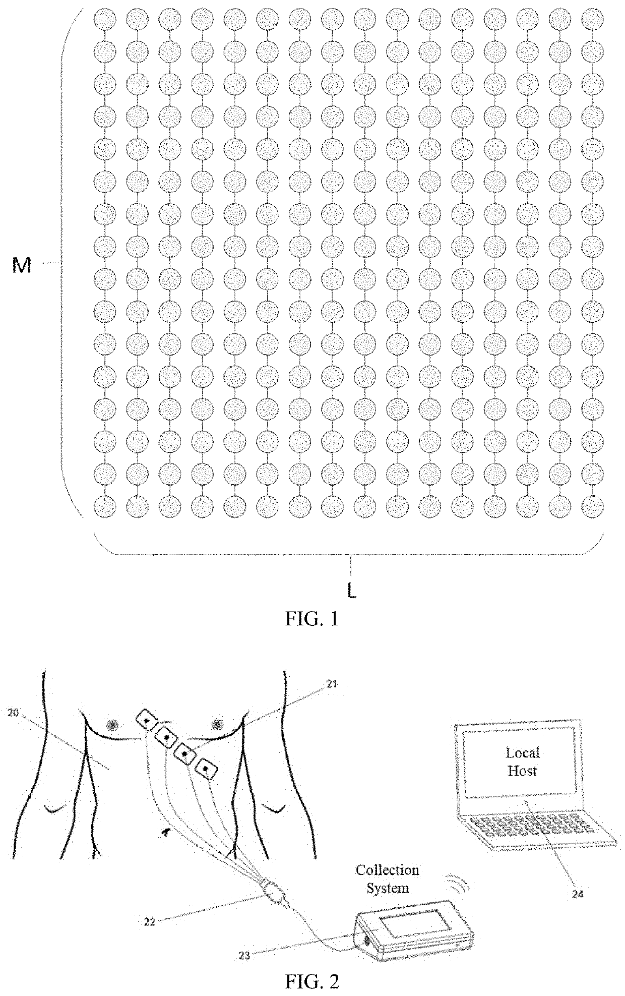 Non-invasive method and system for measuring motion characteristics of myocardial tissue