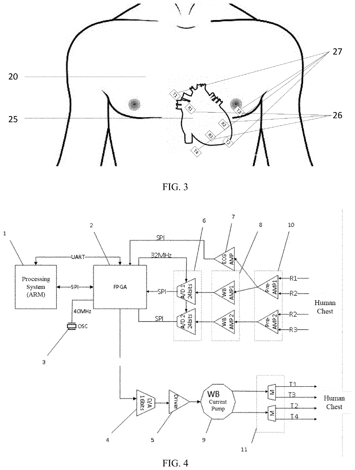 Non-invasive method and system for measuring motion characteristics of myocardial tissue