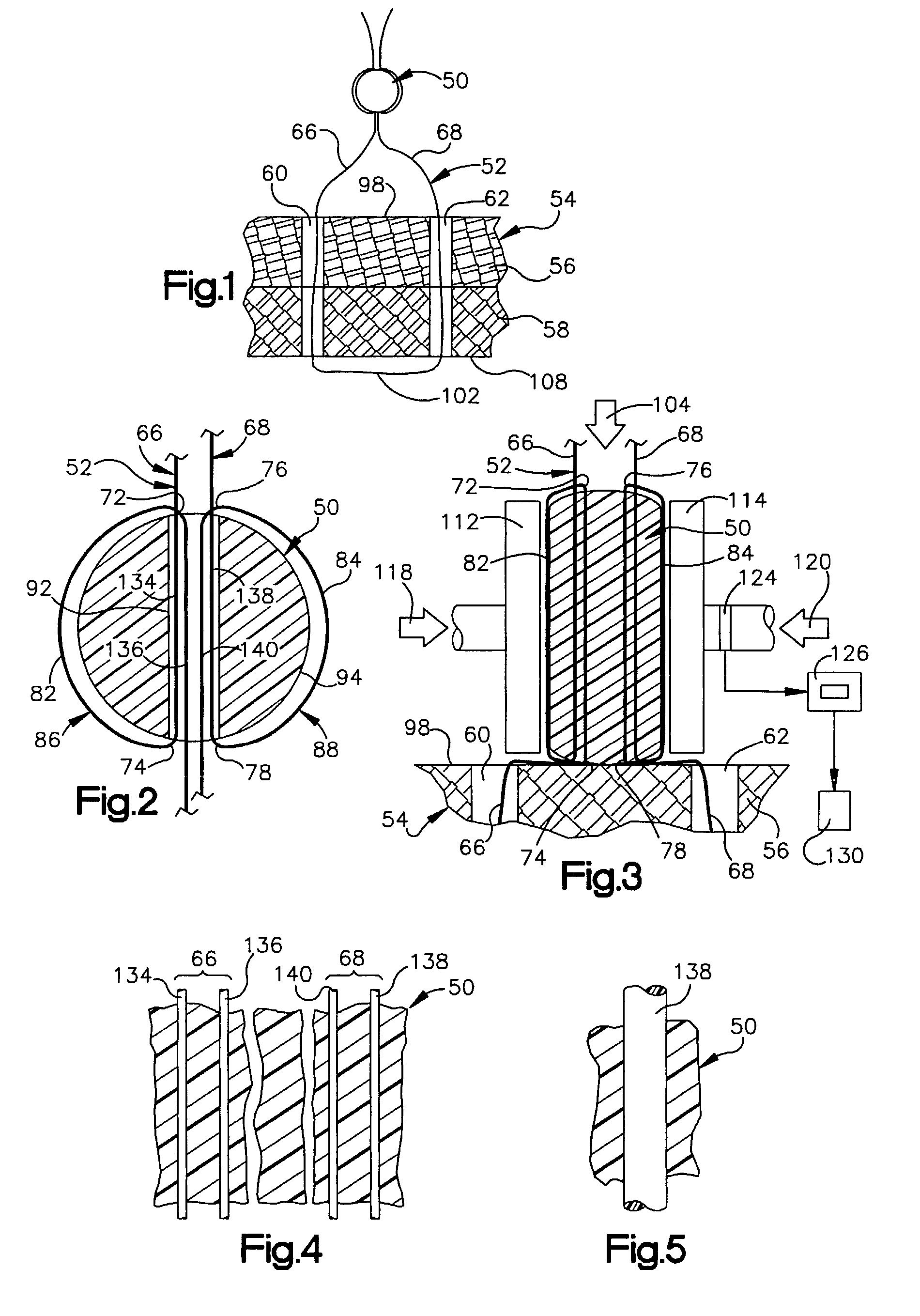 Method and apparatus for securing a suture