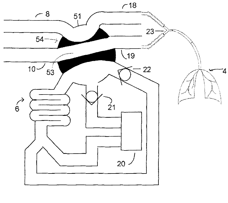 Device and method for supplying breathing air to breathe