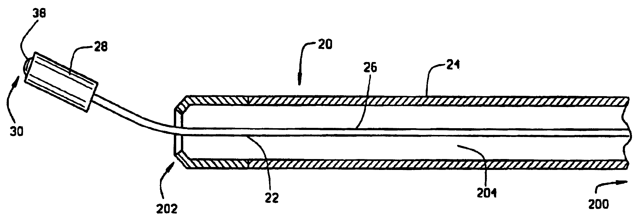 Method of and apparatus for navigating medical devices in body lumens by a guide wire with a magnetic tip