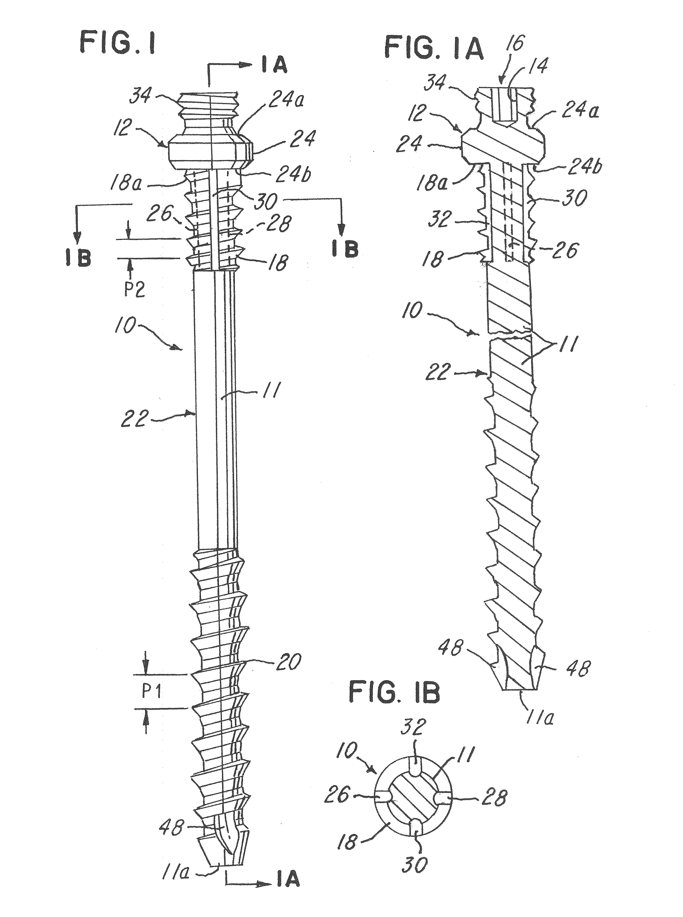 Minimally invasive spinal facet compression screw and system for bone joint fusion and fixation
