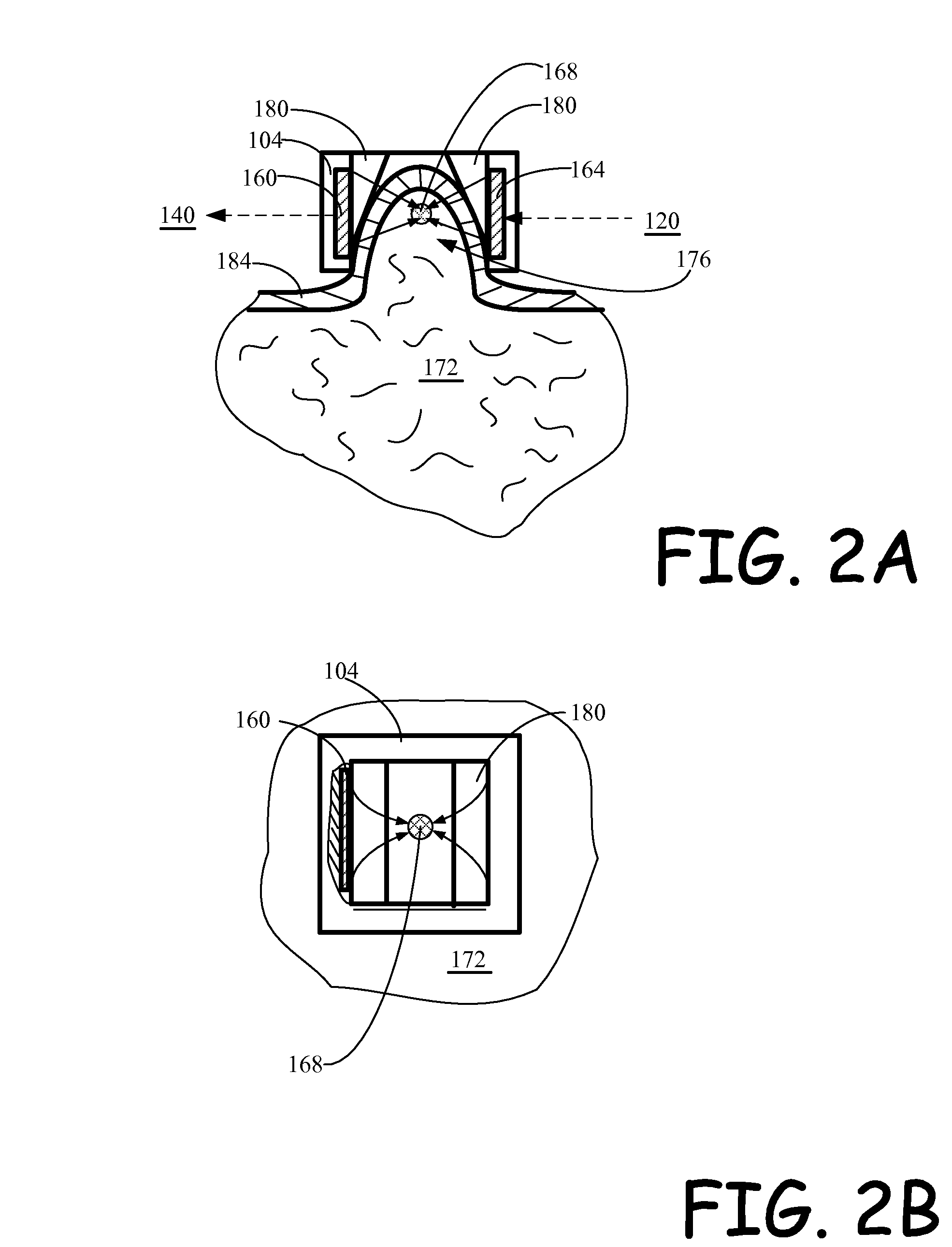 Method and apparatus for ultrasound tissue treatment