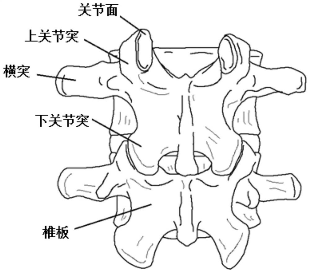 Single-side and double-side spine and lumbar vertebra damping zygopophysis prosthesis