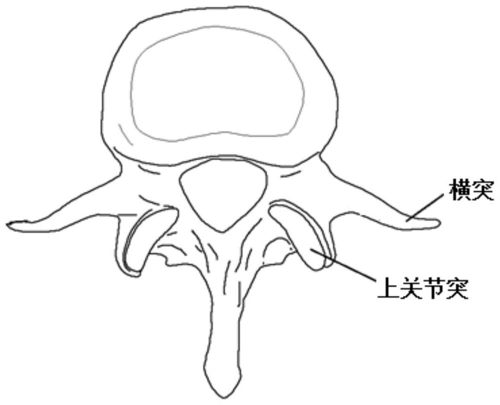 Single-side and double-side spine and lumbar vertebra damping zygopophysis prosthesis