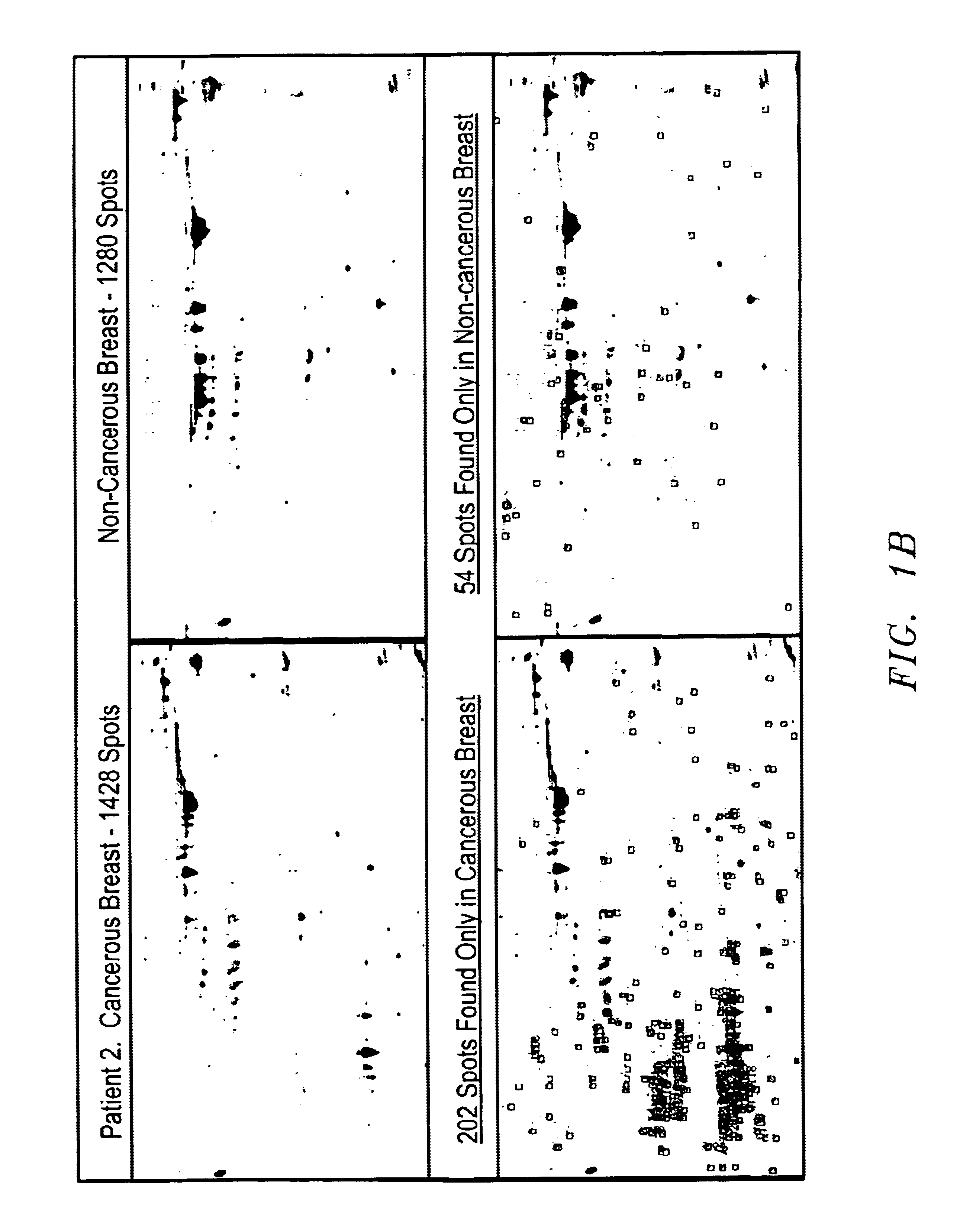 Methods and compositions for detection of breast cancer