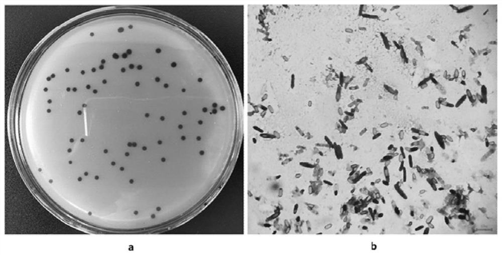 A greening bacteria agent for increasing the chlorophyll content of green leafy vegetables and its preparation method and application