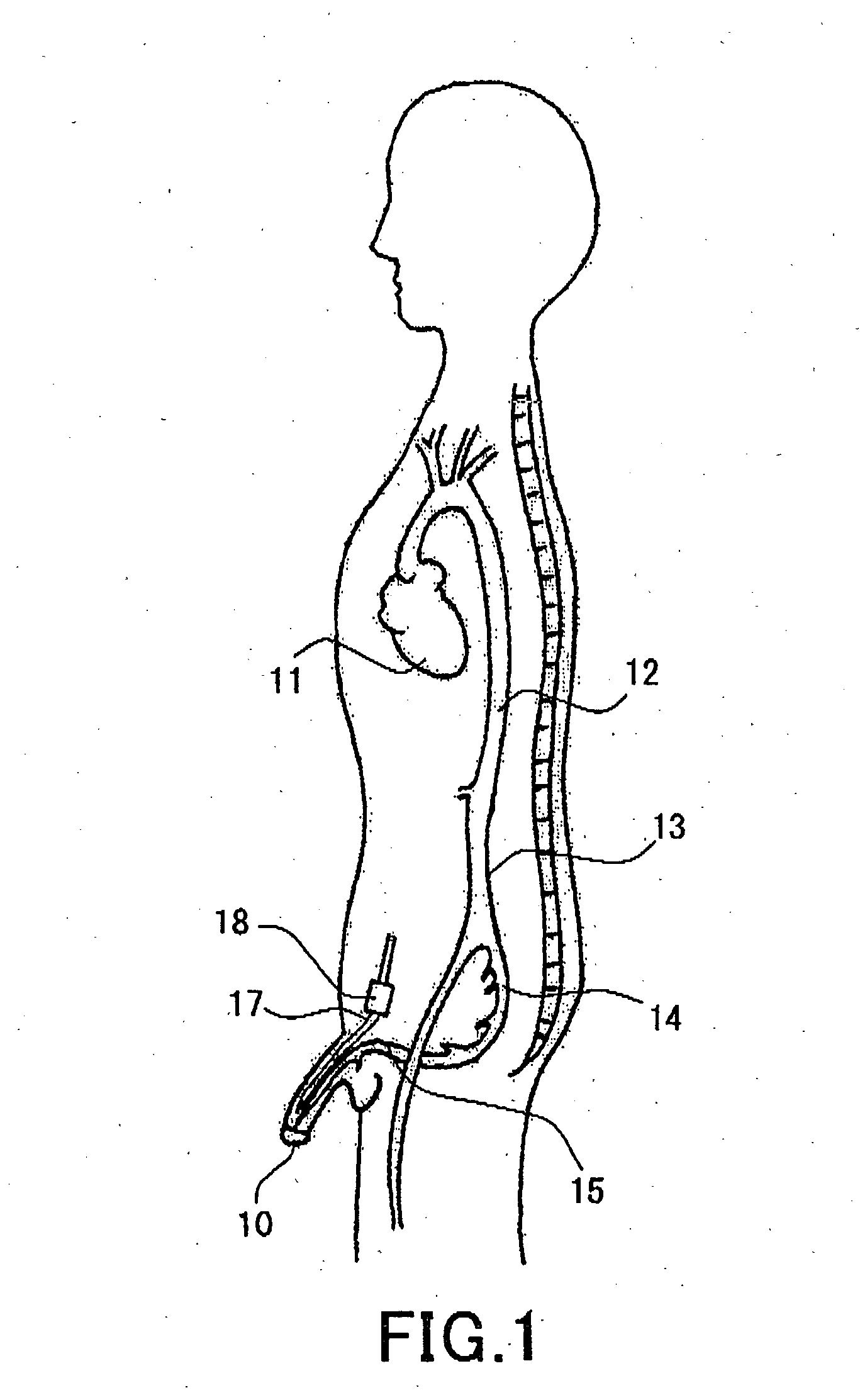 Penile erection control method and penile erection control device