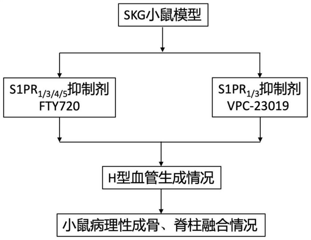 Use of S1P receptor inhibitor in preparing product for preventing and treating ankylosing spondylitis