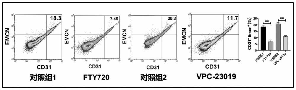 Use of S1P receptor inhibitor in preparing product for preventing and treating ankylosing spondylitis