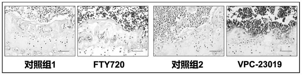 Use of S1P receptor inhibitor in preparing product for preventing and treating ankylosing spondylitis