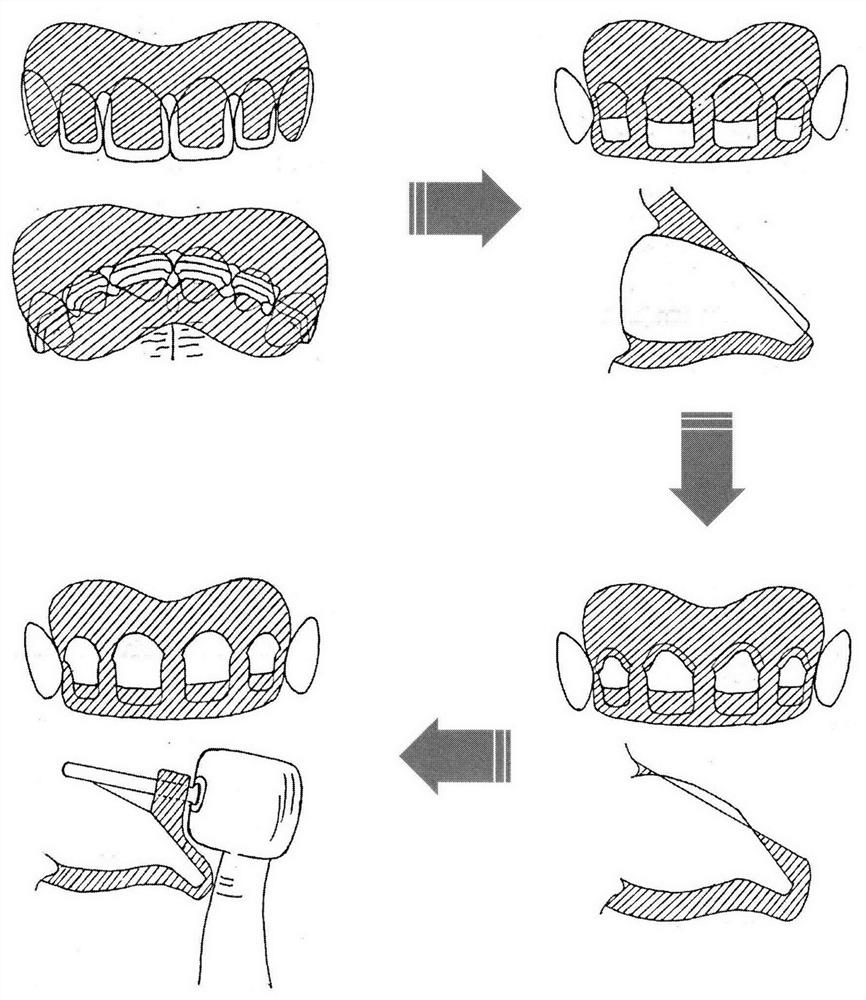 A digitally designed personalized step-by-step instruction guide for tooth preparation