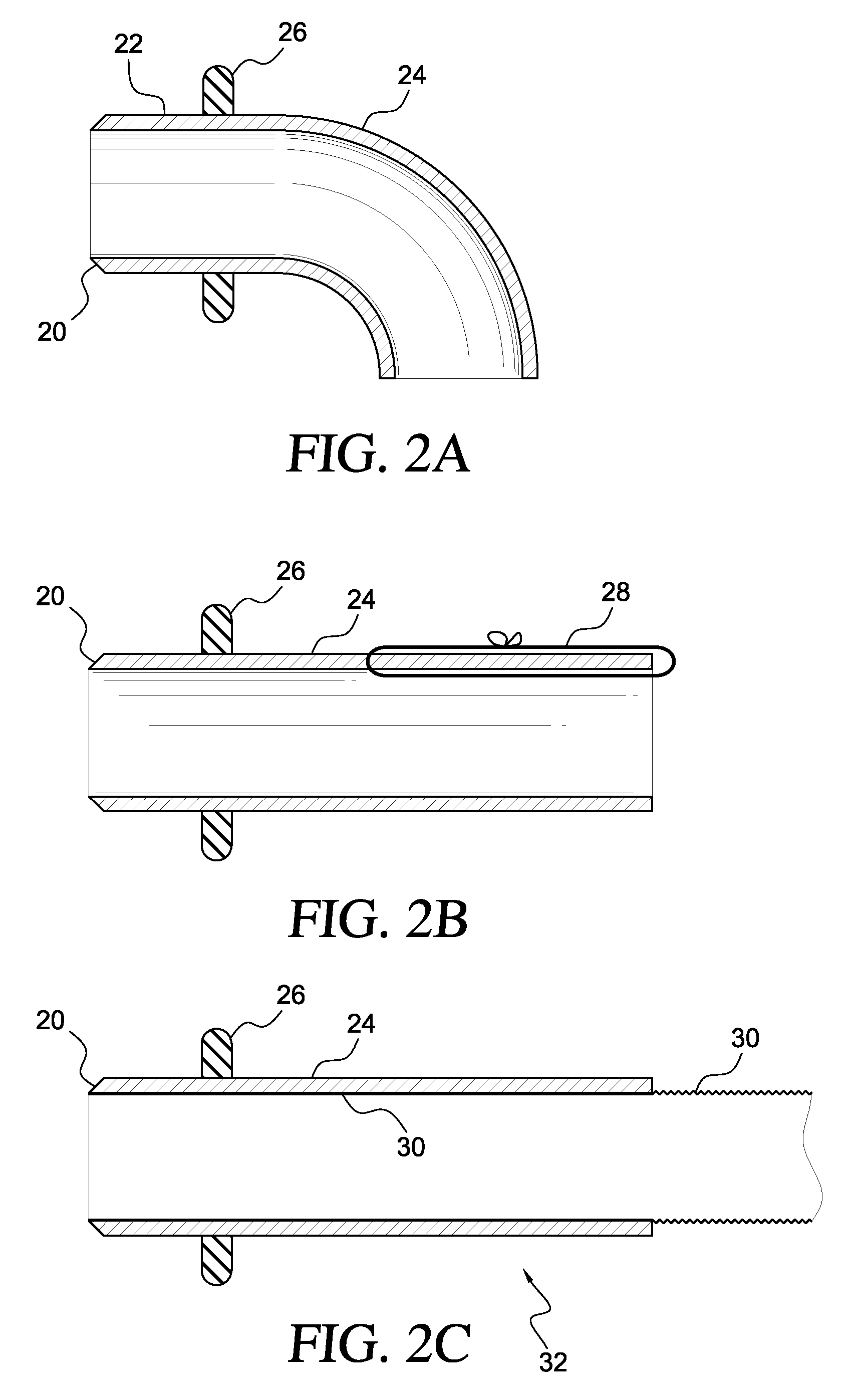 Apparatus and method for suturelessly connecting a conduit to a hollow organ