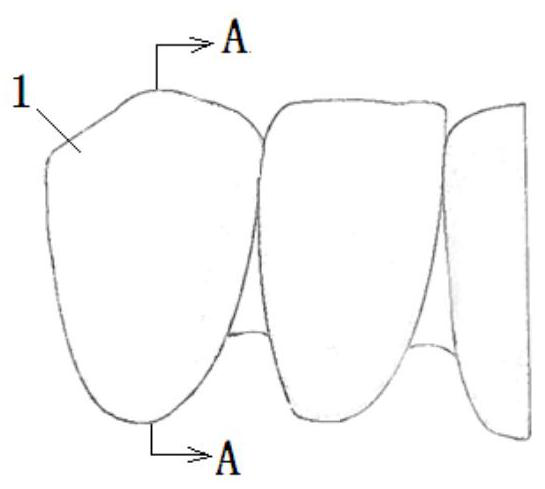 Design and manufacture method of incisal-end positioning windowless veneer without shoulder