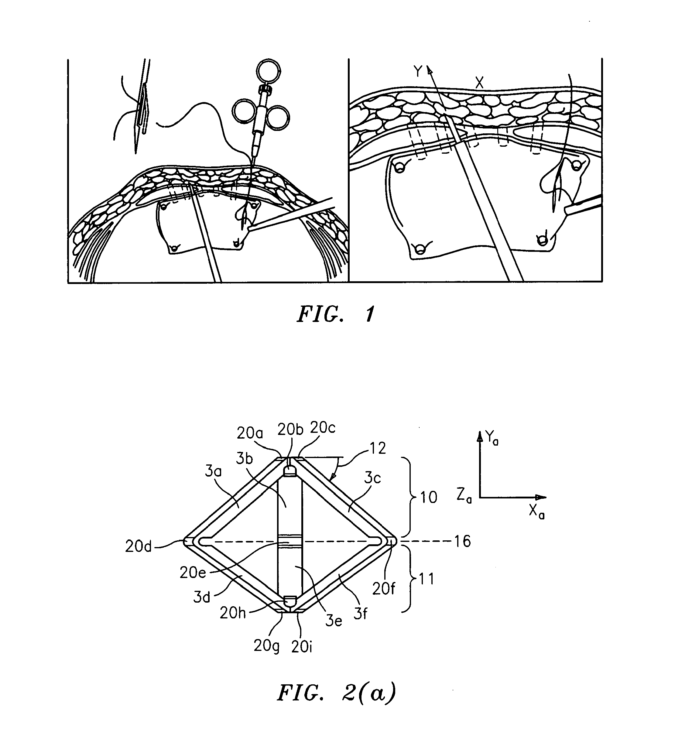 System and method for hernia mesh fixation