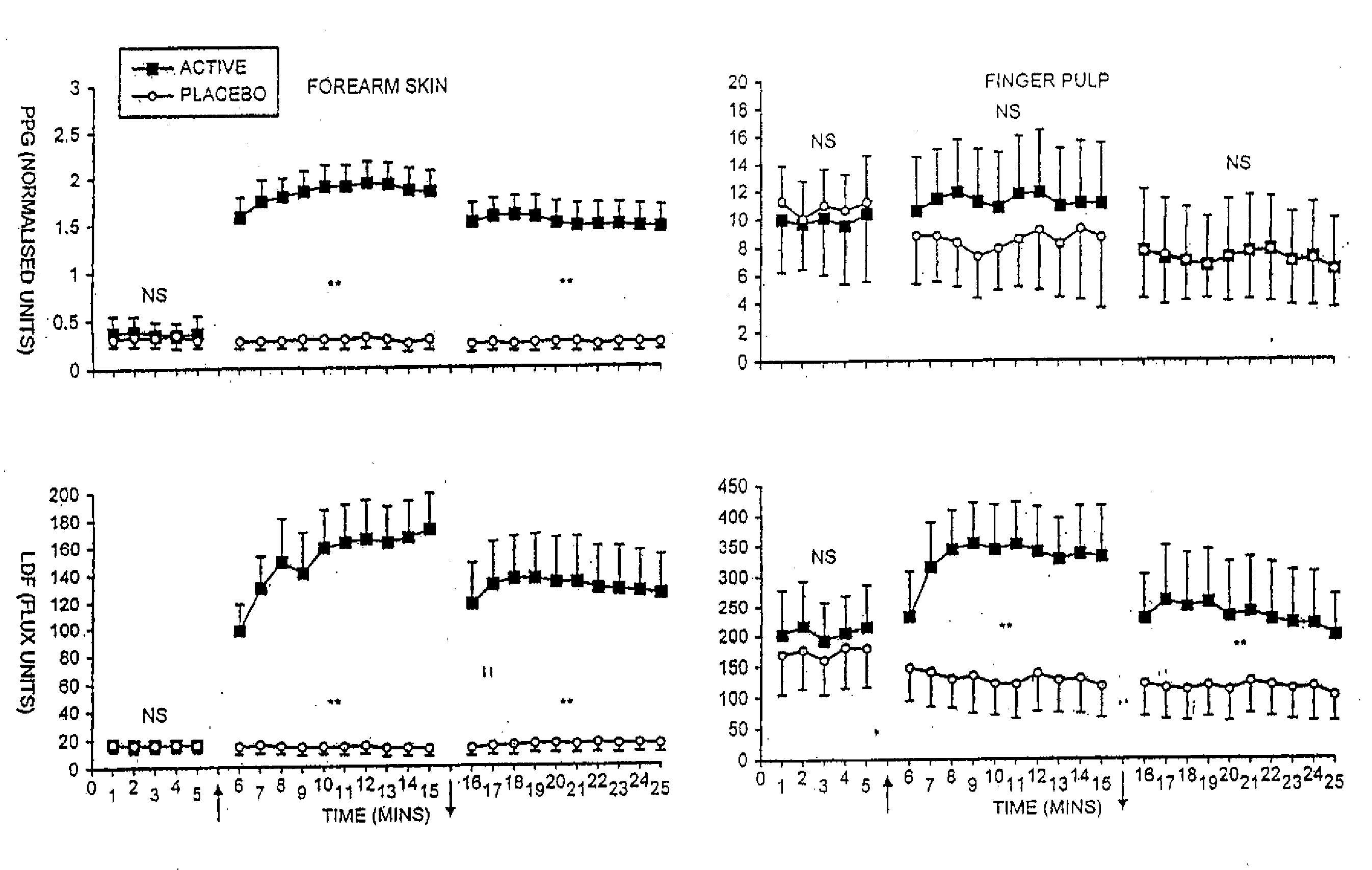 Pharmaceutical composition containing nitrate source and an acidifying agent for treating skin ischaemia