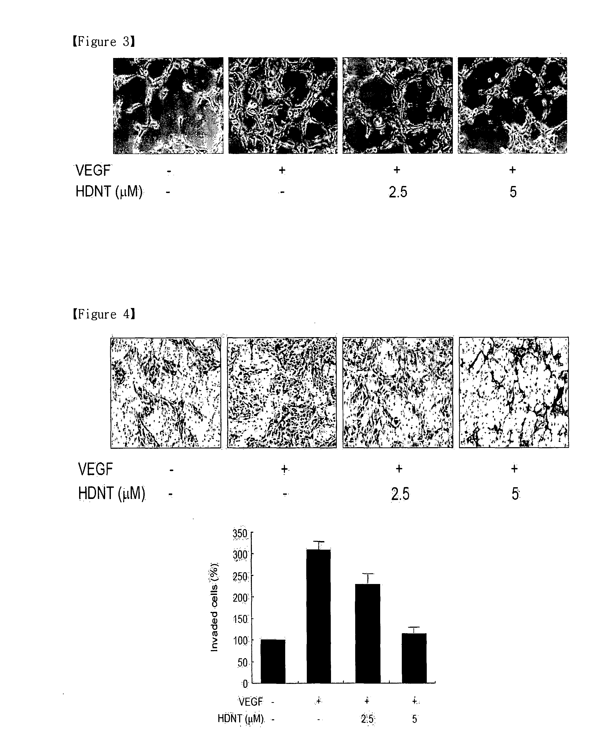 Pharmaceutical compositions for inhibiting angiogenesis