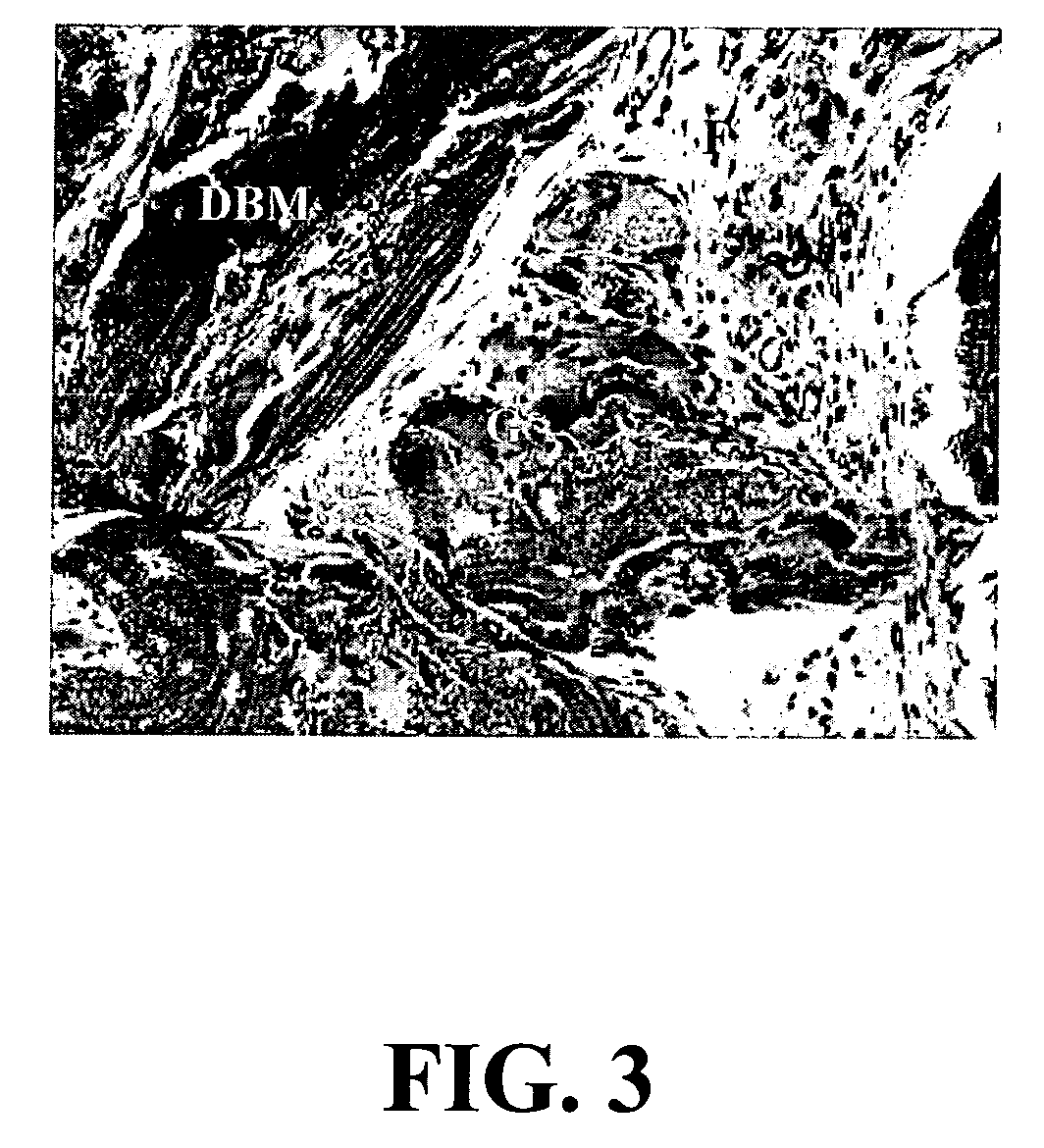 Crosslinked compositions comprising collagen and demineralized bone matrix, methods of making and methods of use