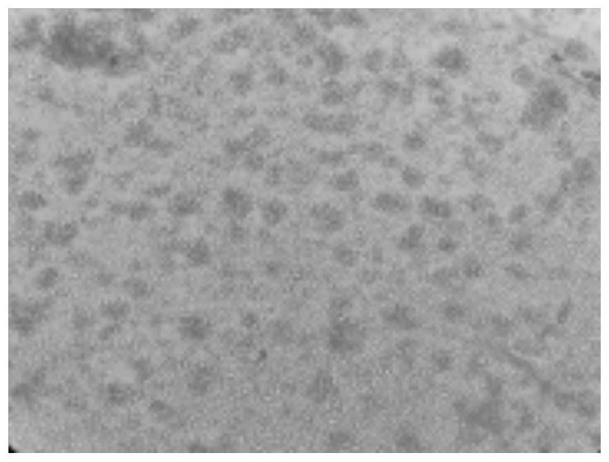 Human peripheral blood immune cell cryopreservation efficient stabilizer, application and cryopreservation method