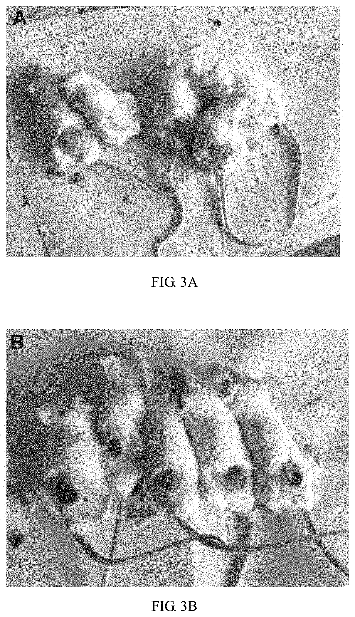 Bacteriologically-modified whole-cell tumor vaccine and method of making same