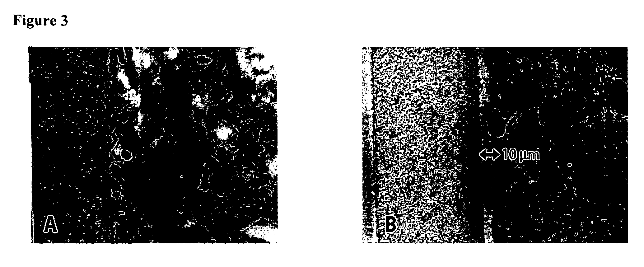 Micronized device for the delivery of biologically active molecules and methods of use thereof