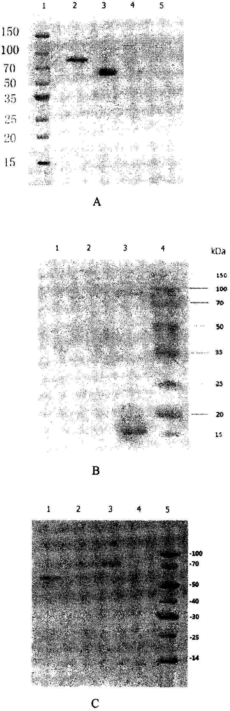 Use of carrier peptides for linking B epitope or semiantigen and immunogen containing carrier peptide in medicine and immunology