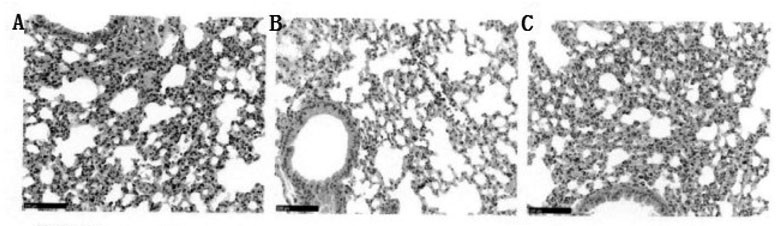 Application of traditional Chinese medicine composition in preparation of anti-SARS (severe acute respiratory syndrome) virus medicine