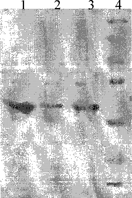 Method for preparing enterotoxin C2 protein