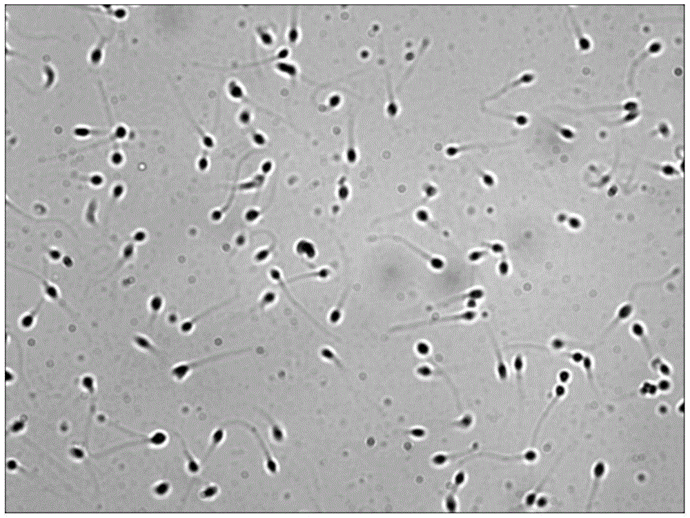 A method for detecting sperm motility