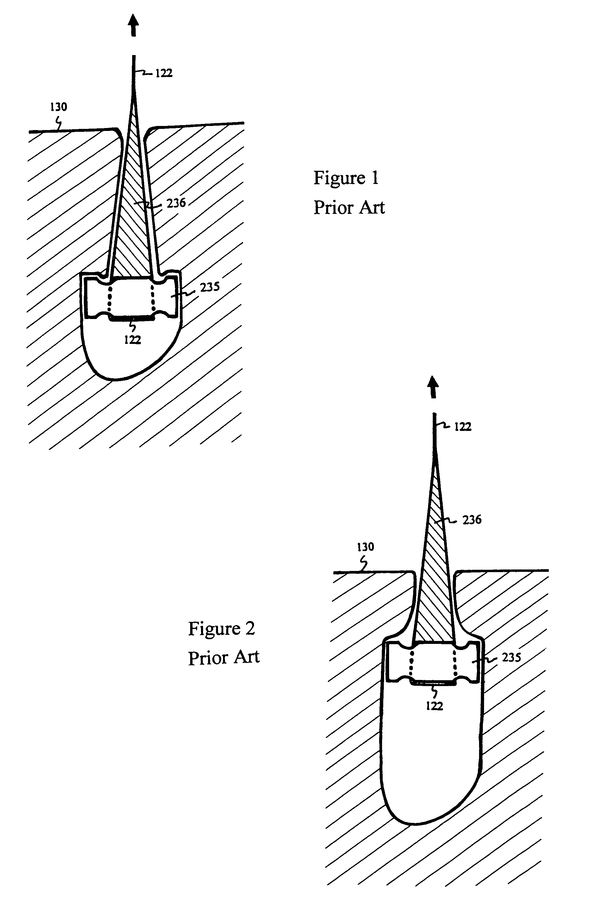 Suture anchor and approximating device